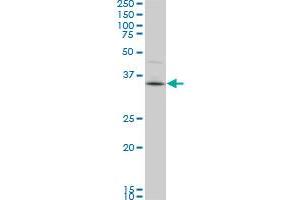 Western Blotting (WB) image for anti-PDZ Binding Kinase (PBK) (AA 1-110) antibody (ABIN599273) (PBK Antikörper  (AA 1-110))