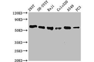 Western Blot Positive WB detected in: 293T whole cell lysate, SH-SY5Y whole cell lysate, Raji whole cell lysate, Colo320 whole cell lysate, A549 whole cell lysate, PC3 whole cell lysate All lanes: FTO antibody at 0. (Rekombinanter FTO Antikörper)