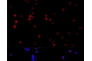 Immunofluorescence analysis of PC-12 cells using TBP Polyclonal Antibody at dilution of 1:100 (40x lens). (TBP Antikörper)