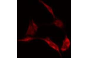 ABIN6278151 staining  Hela cells by IF/ICC. (LGALS1/Galectin 1 Antikörper)