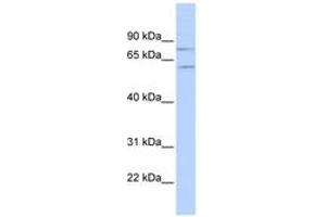 Image no. 1 for anti-Protein Inhibitor of Activated STAT, 1 (PIAS1) (N-Term) antibody (ABIN6742834) (PIAS1 Antikörper  (N-Term))
