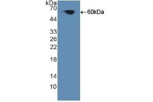 Detection of Recombinant PKCq, Human using Polyclonal Antibody to Protein Kinase C Theta (PKCq) (PKC theta Antikörper  (AA 380-634))