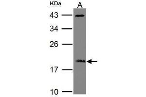 WB Image Sample (30 ug of whole cell lysate) A: Raji 12% SDS PAGE ADP-ribosylation factor 3 antibody antibody diluted at 1:1000 (ARF3 Antikörper)