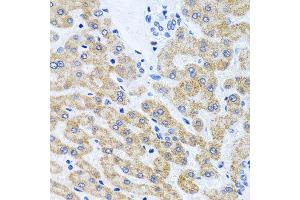 Immunohistochemistry of paraffin-embedded human liver using SCO1 antibody at dilution of 1:100 (x40 lens).