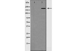 Western blot analysis of MAP2 expression in mouse brain,The lane on the left is treated with the antigen-specific peptide. (MAP2 Antikörper  (N-Term))