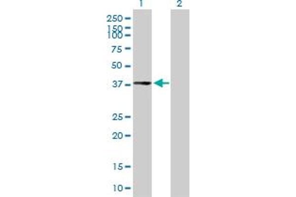 CPXCR1 Antikörper  (AA 1-301)