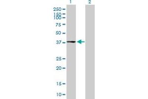 Western Blot analysis of CPXCR1 expression in transfected 293T cell line by CPXCR1 MaxPab polyclonal antibody. (CPXCR1 Antikörper  (AA 1-301))