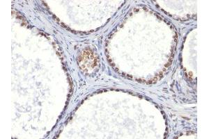 Image no. 1 for anti-Androgen Receptor (AR) (AA 299-315) antibody (ABIN6156150) (Androgen Receptor Antikörper  (AA 299-315))
