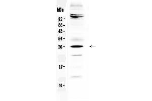 Western blot analysis of SRY using anti-SRY antibody . (SRY Antikörper  (Middle Region))