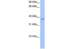 WB Suggested Anti-SPRY2 Antibody Titration:  0.