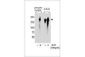 Western blot analysis of extracts from A431 cell,untreated or treated with EGF,using phospho-ERBB2- (left) or ErBB2 Antibody (right). (ErbB2/Her2 Antikörper  (pTyr1005))