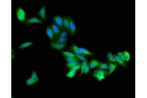 Immunofluorescent analysis of HepG2 cells using ABIN7176655 at dilution of 1:100 and Alexa Fluor 488-congugated AffiniPure Goat Anti-Rabbit IgG(H+L) (ZSWIM6 Antikörper  (AA 430-583))