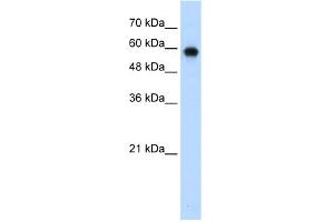 WB Suggested Anti-SMARCD2 Antibody Titration:  0. (SMARCD2 Antikörper  (C-Term))