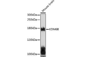 Western blot analysis of extracts of mouse brain, using KDM6B antibody (ABIN6131823, ABIN6142806, ABIN6142809 and ABIN6216507) at 1:1000 dilution. (Kdm6b Antikörper  (AA 265-450))