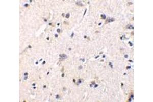 Immunohistochemistry of GFR alpha 1 in human brain tissue with GFR alpha 1 antibody at 1 μg/ml. (GFRA1 Antikörper  (Intermediate Domain))