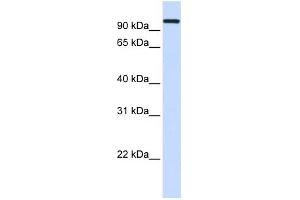 HSPA4 antibody used at 1 ug/ml to detect target protein. (HSPA4 Antikörper  (Middle Region))