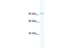 WB Suggested Anti-PIK3CB Antibody Titration:  5ug/ml  Positive Control:  Human brain (PIK3CB Antikörper  (C-Term))