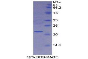SDS-PAGE (SDS) image for Peroxiredoxin 6 (PRDX6) (AA 1-224) protein (His tag) (ABIN1080506)