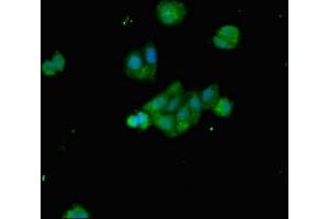Immunofluorescent analysis of HepG2 cells using ABIN7145302 at dilution of 1:100 and Alexa Fluor 488-congugated AffiniPure Goat Anti-Rabbit IgG(H+L) (BIM Antikörper  (AA 1-198))