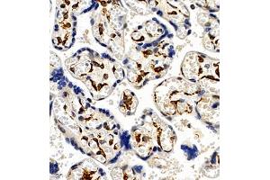 Immunohistochemistry of paraffin embedded human placenta using CCRL2 (ABIN7073461) at dilution of 1:300 (400x lens) (CCRL2 Antikörper)