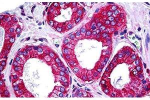 Human Prostate: Formalin-Fixed, Paraffin-Embedded (FFPE) (TRAF3IP2 Antikörper  (AA 451-566))
