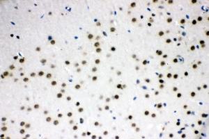 IHC analysis of SF2/SRSF1 using anti-SF2/SRSF1 antibody (ABIN3043296). (SRSF1 Antikörper  (N-Term))