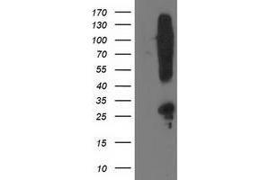 HEK293T cells were transfected with the pCMV6-ENTRY control (Left lane) or pCMV6-ENTRY SNAP25 (Right lane) cDNA for 48 hrs and lysed. (SNAP25 Antikörper)