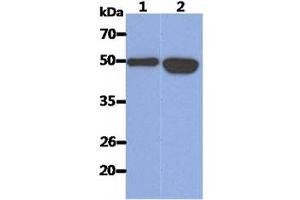 The Recombinant Human KRT14 (50ng) and Cell lysates (40ug) were resolved by SDS-PAGE, transferred to PVDF membrane and probed with anti-human KRT14 antibody (1:1000). (KRT14 Antikörper  (AA 1-472))