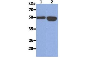 The Recombinant Human KRT14 (50ng) and Cell lysates (40ug) were resolved by SDS-PAGE, transferred to PVDF membrane and probed with anti-human KRT14 antibody (1:1000). (KRT14 Antikörper)