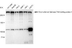 Western blotting analysis using Chromodomain helicase DNA binding protein 4 antibody (ABIN7800918). (Rekombinanter Chromodomain Helicase DNA Binding 4 Antikörper)
