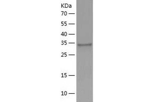 PPIE Protein (AA 2-301) (His tag)