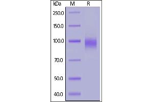 Human EGF R, His Tag on  under reducing (R) condition. (EGFR Protein (AA 25-645) (His tag))