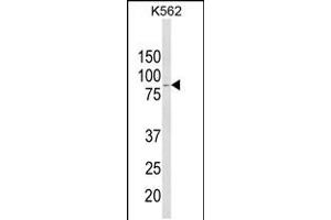 Western blot analysis of ALDH18A1 Antibody in K562 cell line lysates (35ug/lane) (P5CS Antikörper  (AA 176-205))
