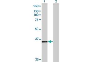 Western Blot analysis of POLK expression in transfected 293T cell line by POLK MaxPab polyclonal antibody.