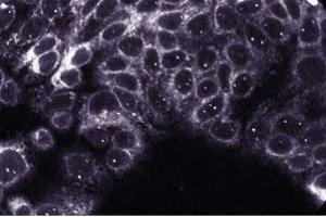 Image no. 2 for anti-Protein tyrosine Phosphatase, Non-Receptor Type 1 (PTPN1) (AA 269-435) antibody (ABIN967772)