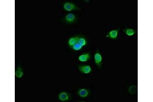 Immunofluorescence staining of A549 cells with ABIN7165136 at 1:133, counter-stained with DAPI. (BICC1 Antikörper  (AA 682-849))