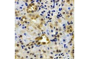 Immunohistochemical analysis of EPHX2 staining in rat kidney formalin fixed paraffin embedded tissue section. (EPHX2 Antikörper)