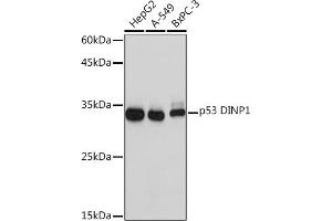 Western blot analysis of extracts of various cell lines, using p53 DINP1 Rabbit mAb (ABIN7271097) at 1:1000 dilution. (TP53INP1 Antikörper)