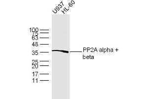 Lane 1: U937 lysates Lane 2: HL-60 lysates probed with PP2A alpha + beta Polyclonal Antibody, Unconjugated  at 1:300 dilution and 4˚C overnight incubation.