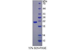 SDS-PAGE analysis of Mouse EPRS Protein.