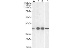 ABIN5539547 (0. (Ketohexokinase Antikörper  (Internal Region))