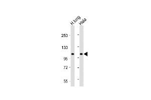 All lanes : Anti-NAT10 Antibody (N-Term) at 1:2000 dilution Lane 1: Human lung lysate Lane 2: Hela whole cell lysate Lysates/proteins at 20 μg per lane. (NAT10 Antikörper  (AA 146-178))
