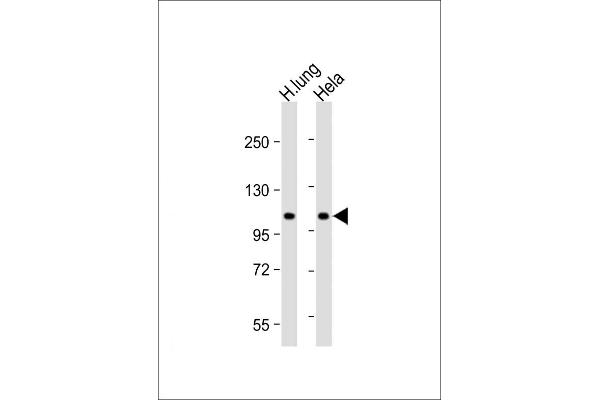 NAT10 Antikörper  (AA 146-178)