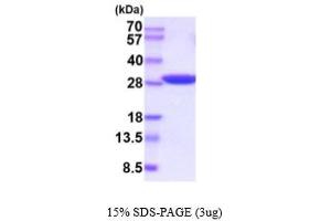 SDS-PAGE (SDS) image for Triosephosphate Isomerase 1 (TPI1) (AA 1-249) (Active) protein (His tag) (ABIN6387938) (TPI1 Protein (AA 1-249) (His tag))