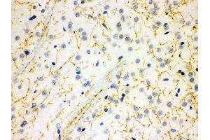 Anti- SLC6A4 Picoband antibody, IHC(P) IHC(P): Rat Brain Tissue (SLC6A4 Antikörper  (N-Term))