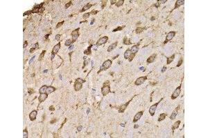 Immunohistochemistry of paraffin-embedded Mouse brain using RPS14 Polyclonal Antibody at dilution of 1:100 (40x lens). (RPS14 Antikörper)