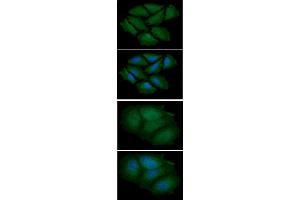 ICC/IF analysis of CNBP in HeLa cells line, stained with DAPI (Blue) for nucleus staining and monoclonal anti-human CNBP antibody (1:100) with goat anti-mouse IgG-Alexa fluor 488 conjugate (Green). (CNBP Antikörper)