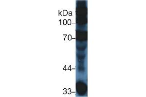 Western Blot; Sample: Mouse Serum; Primary Ab: 5µg/ml Rabbit Anti-Mouse C3a Antibody Second Ab: 0. (C3a Antikörper  (AA 671-748))