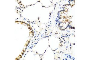 Immunohistochemistry of paraffin-embedded rat lung using IL13 antibody at dilution of 1:100 (40x lens). (IL-13 Antikörper)