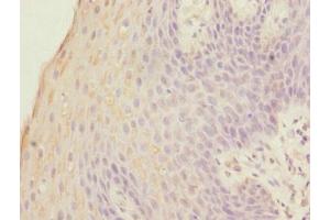 Immunohistochemistry of paraffin-embedded human tonsil tissue using ABIN7153088 at dilution of 1:100 (FOXP1 Antikörper  (AA 1-114))